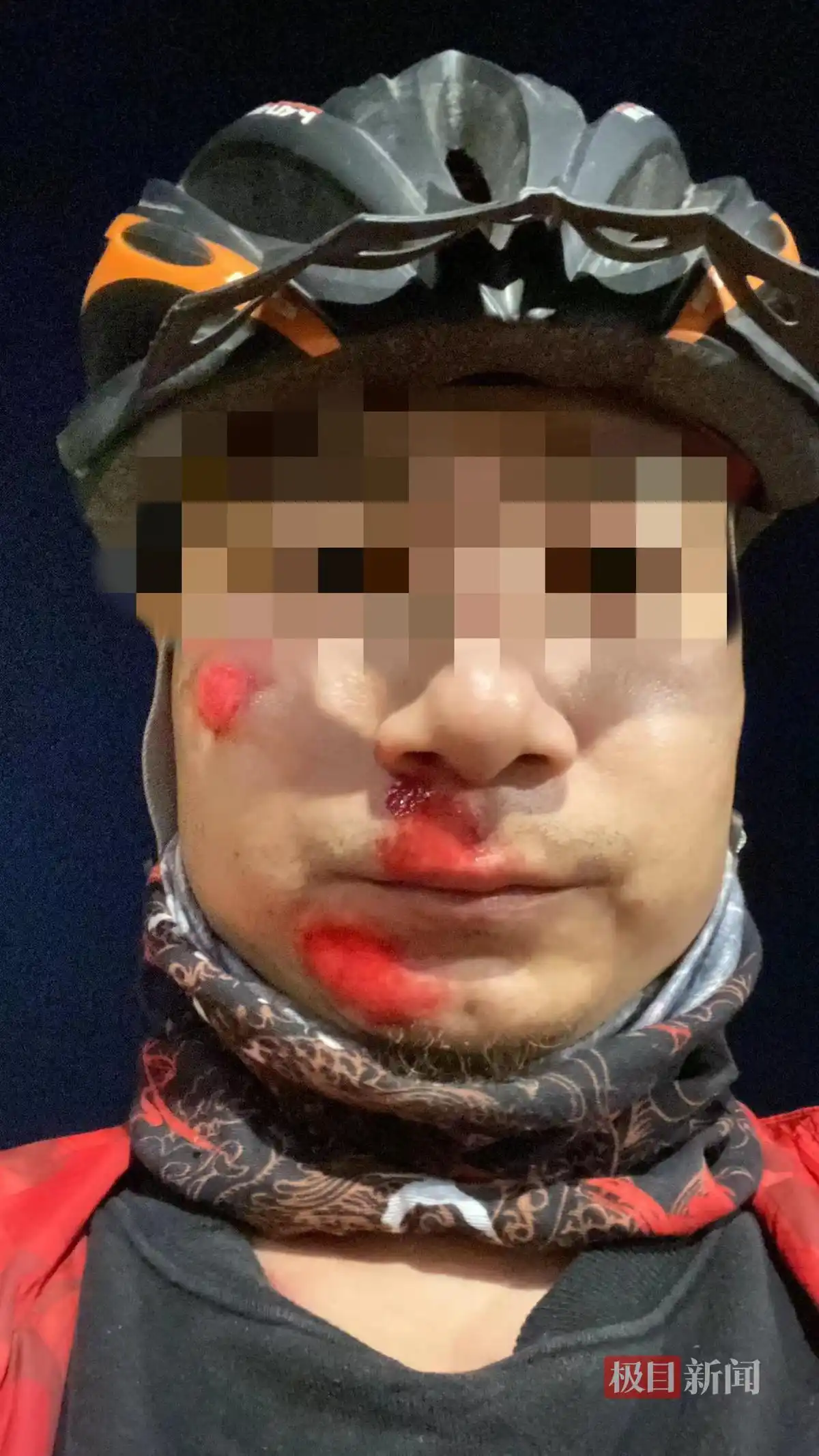 自行车车把断裂赔偿_碳纤维自行车车把风险_山地车的快拆杆会坏吗