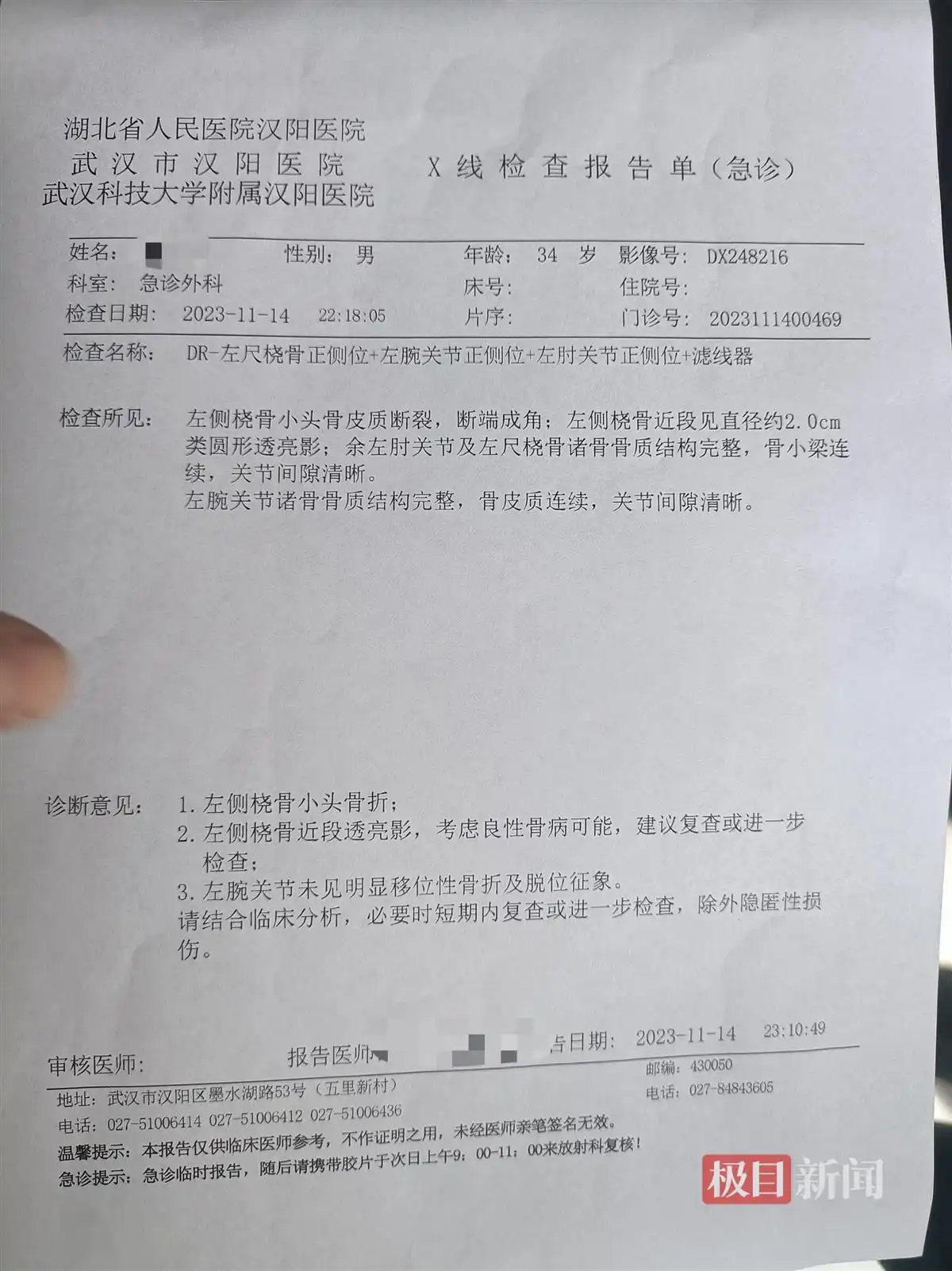 碳纤维自行车车把风险_自行车车把断裂赔偿_山地车的快拆杆会坏吗
