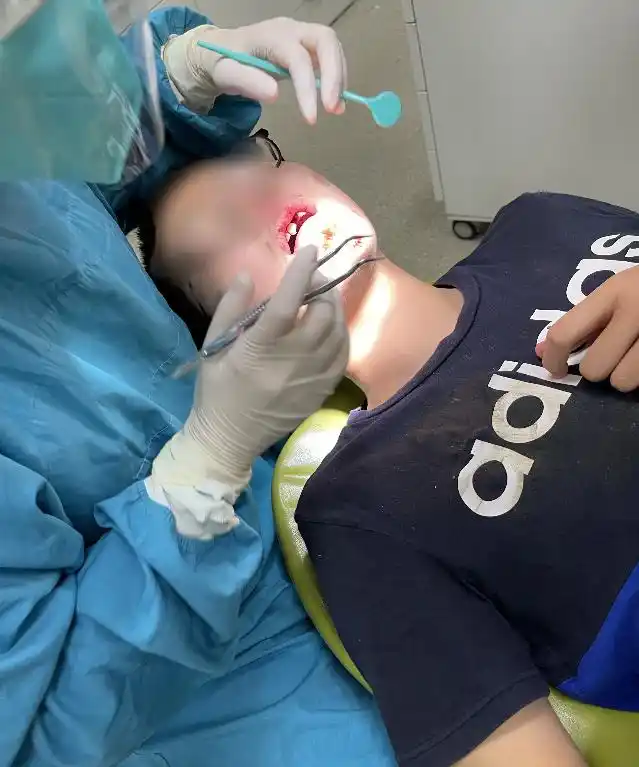 山地车的快拆杆会坏吗_十二岁男孩山地车前轮脱落口腔面部重创_快拆杆松动导致自行车事故